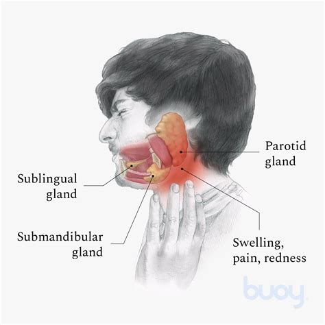 prada gland infection|Sialadenitis (Salivary Gland Infection): Symptoms & Treatment.